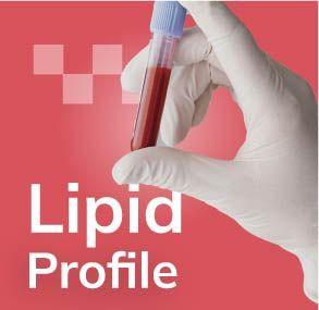 carousel_card_banner_img_Lipid Test: 5 Important Questions Answered