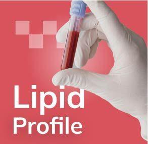 Lipid Test: 5 Important Questions Answered