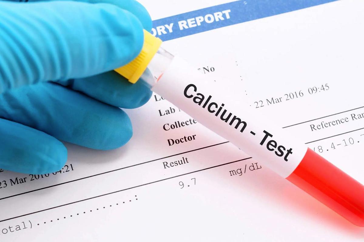 Calcium Blood Test Purpose, Procedure & Results