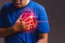 Bradycardia: Symptoms, Causes, Prevention, Diagnosis