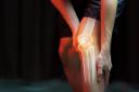 Osteoarthritis: Symptoms, Risk Factor and Treatment