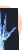 X-Ray, MRI & Scans