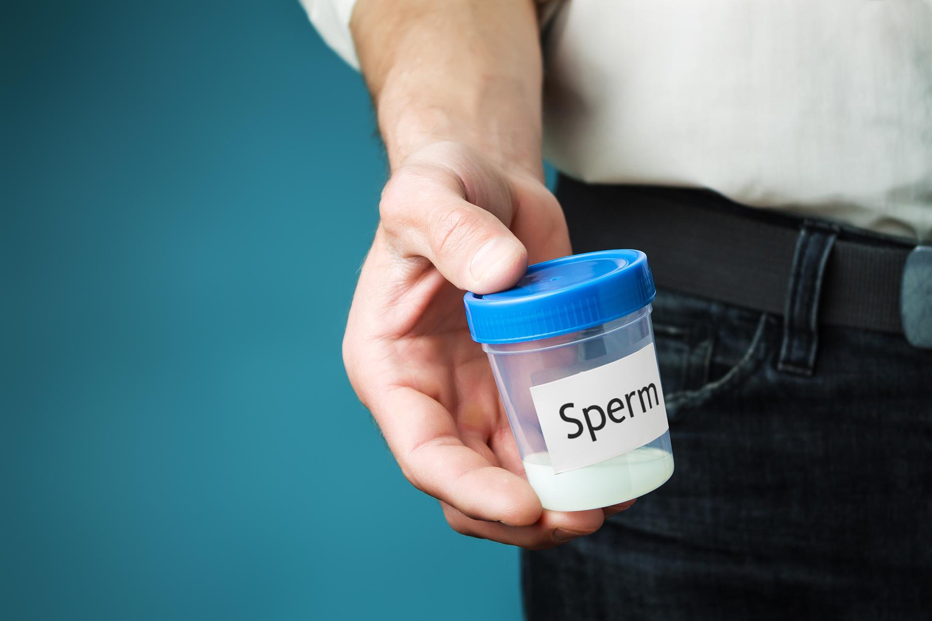 Low Sperm Count: Symptoms, Causes, Diagnosis and Test