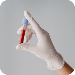 Cholesterol Test: Why and How is It Done? An Important Guide!
