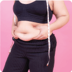 What is Obesity: Causes, Symptoms and Treatment