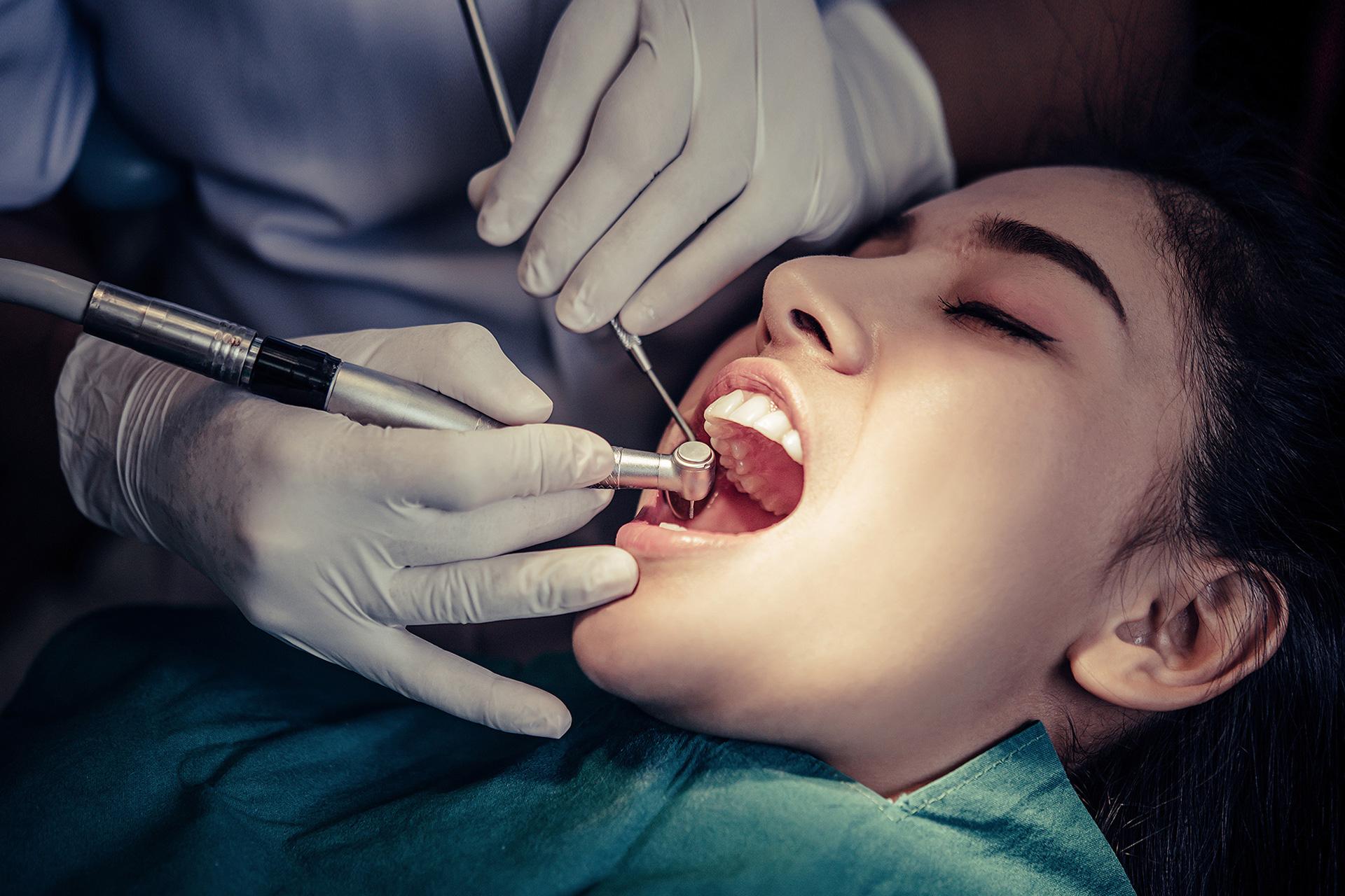 Cracked Tooth Symptoms, Causes, Types and Complications