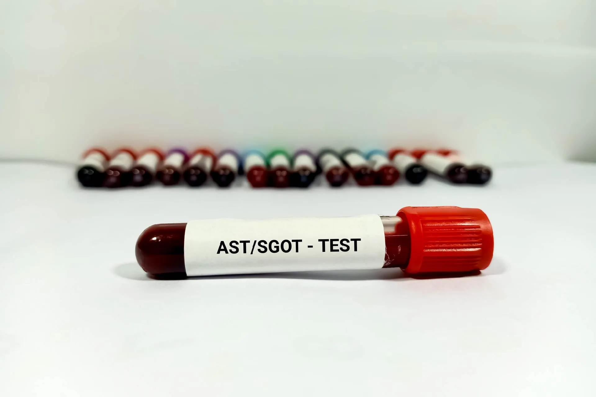 What is the SGOT Normal Range, and What Does it Mean?