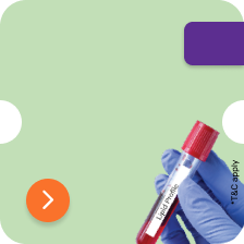 Lipid profile